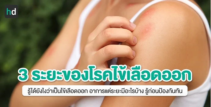 3 ระยะของโรคไข้เลือดออก สังเกตอาการอย่างไร ป้องกันด้วยวิธีไหนดี