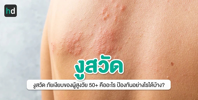 งูสวัด ภัยเงียบของผู้สูงอายุ สุขภาพดีใช่ว่าไม่เสี่ยง!