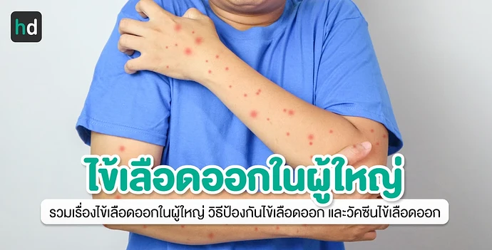 คู่มือรวมเรื่องควรรู้ของ "ไข้เลือดออกในผู้ใหญ่"