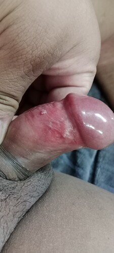 1000021731